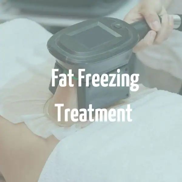 fat freezing treatment Bedfordshire