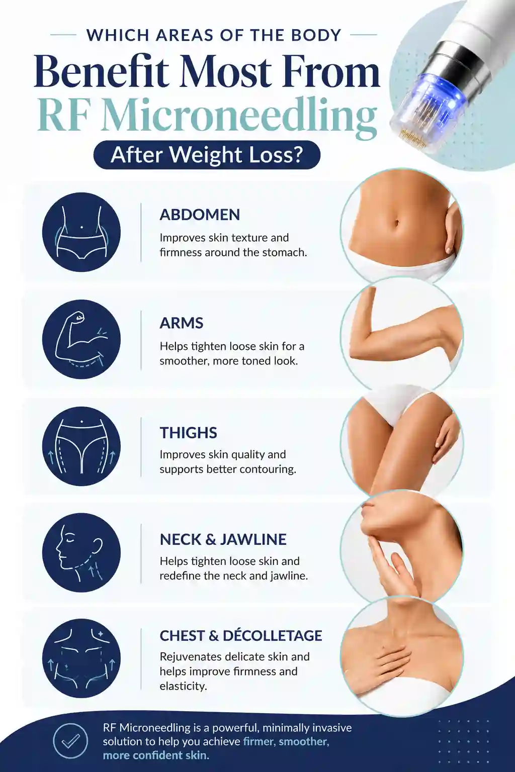 Which Areas of the Body Benefit Most From RF Microneedling After Weight Loss Bedfordshire